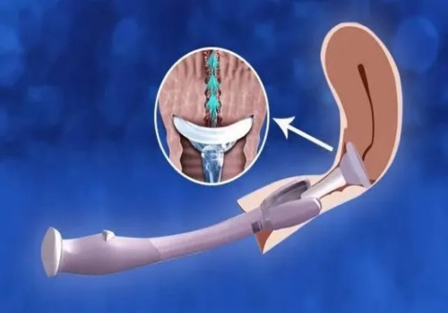 浅谈泰国试管婴儿医院，优点及缺点一目了然