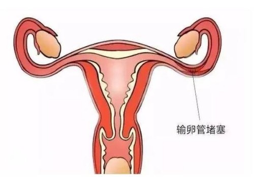 供精试管和人授，哪个更适合你？